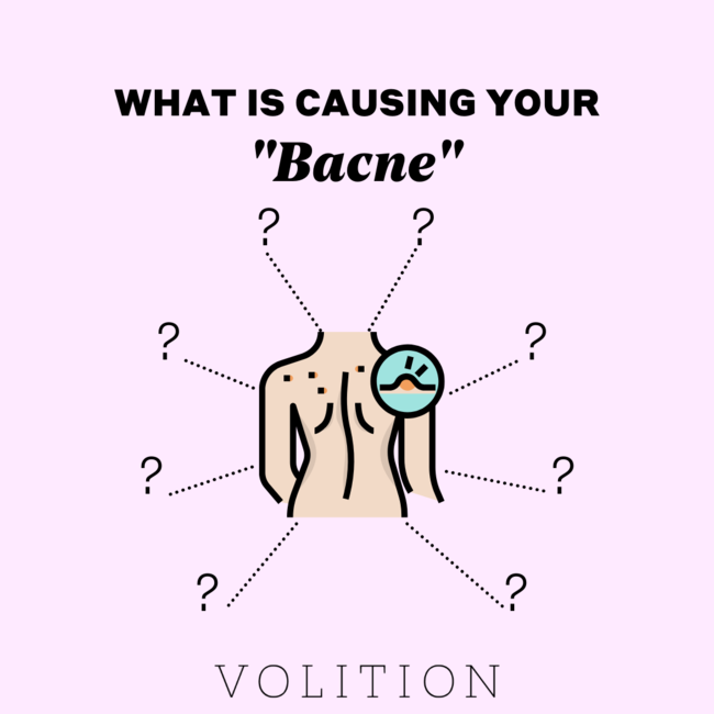 What’s Causing Your Bacne?